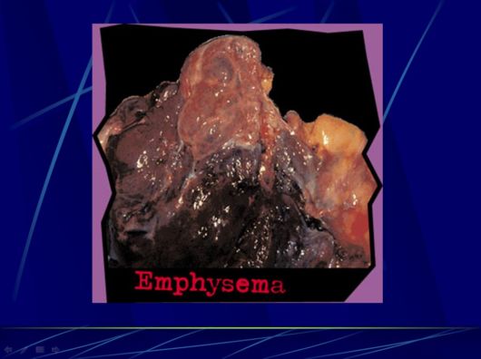 Smoking Facts We Must Know About