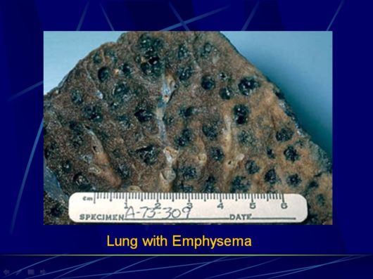 Smoking Facts We Must Know About