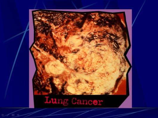 Smoking Facts We Must Know About