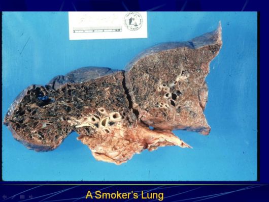 Smoking Facts We Must Know About