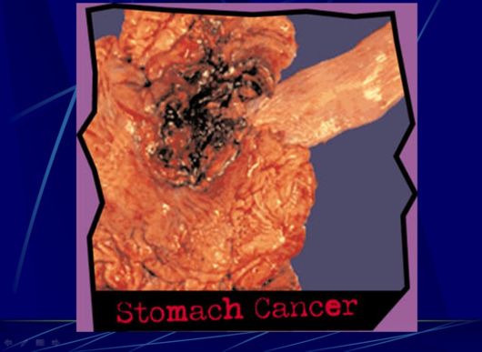 Smoking Facts We Must Know About