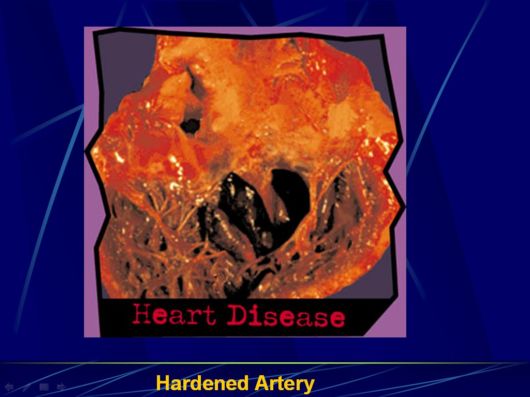 Smoking Facts We Must Know About